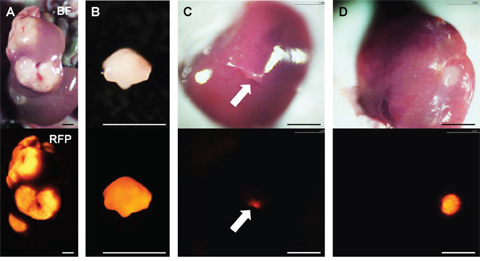Establishment of orthotopic liver metastasis mouse models.