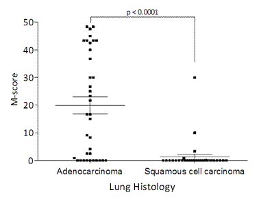M-score Distribution of FRA Expression in Lung Adenocarcinoma and Squamous Cell Carcinoma.