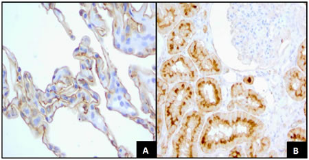 FRA Expression in Normal Tissues.