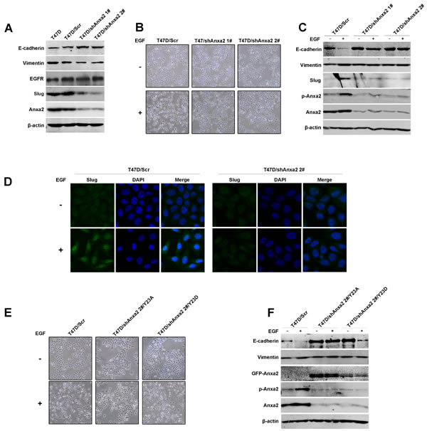 Anxa2 is required for EGF-induced EMT in human breast cancer cells.