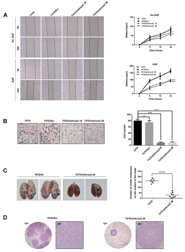 Depletion of Anxa2 expression impairs invasive potential of T47D cells