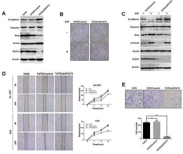 Downregulation of STAT3 expression inhibits EGF-induced EMT and cell migration and invasion in T47D cells.