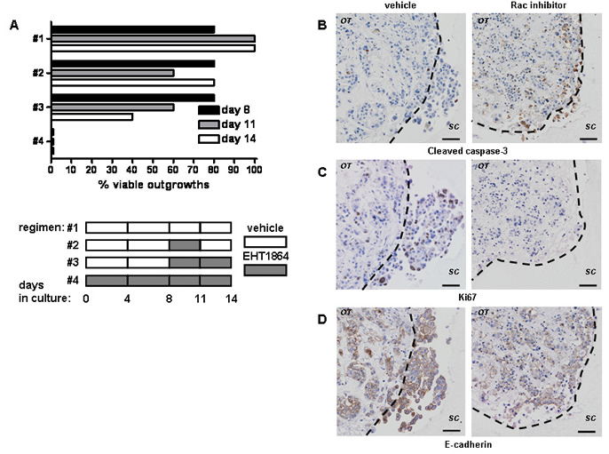 Rac inhibition with of tumour outgrowth ex vivo results in block of proliferation and cell death.