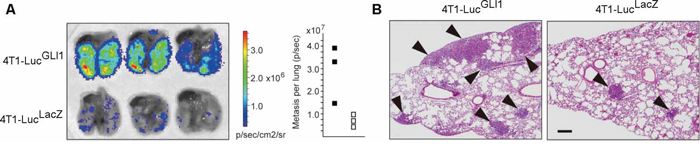 GLI activity enhances the lung metastasis of mouse breast cancer cells.