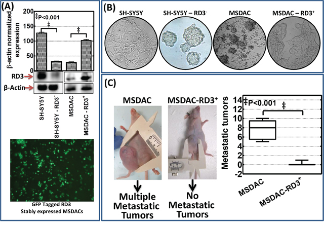 RD3 regulates metastatic potential of neuroblastoma cells.