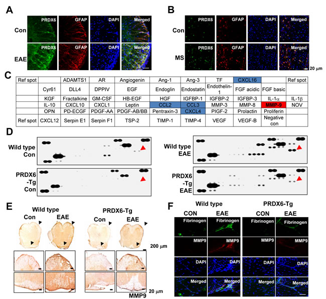 PRDX6 is increased in astrocytes and prevents blood-brain-barrier disruption.