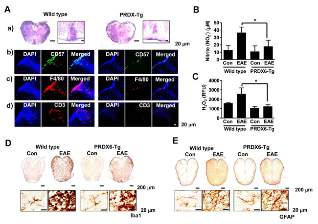 PRDX6 attenuates immune cell infiltration and neuroinflammation in EAE.