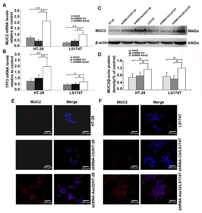 Ascl2 knockdown in CRC cell lines increased expression of goblet cell specific genes.