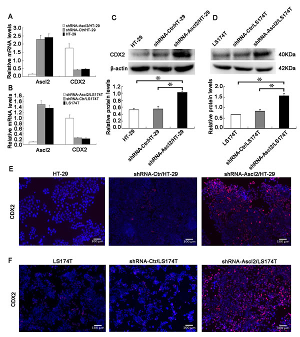 Ascl2 knockdown in CRC cell lines increased CDX2 expression.