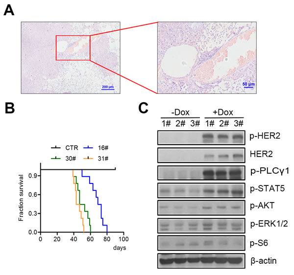 H878Y mutant HER2 is tumorigenic