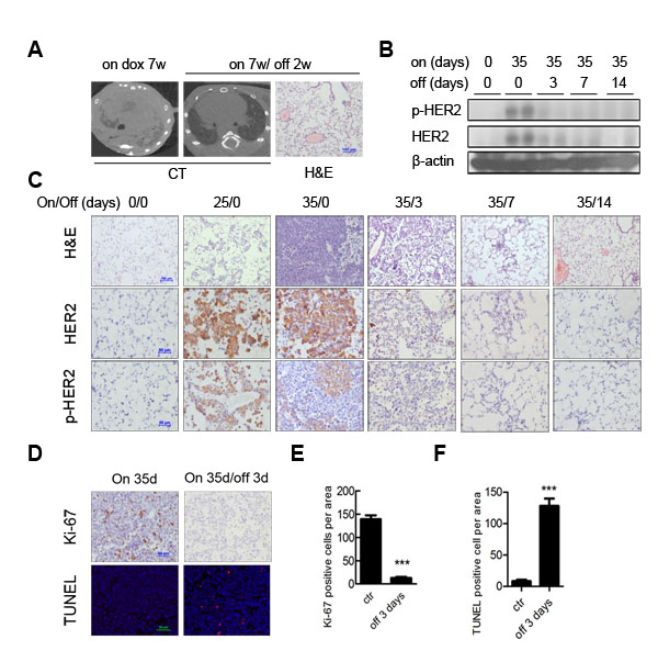 HER2 H878Y driven lung tumor depends on continuous expression of transgene for maintenance.