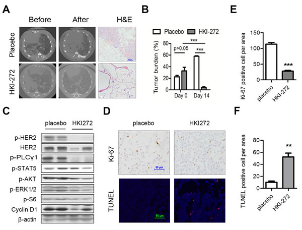 HER2 H878Y-driven lung tumor is sensitive to HKI-272 treatment.