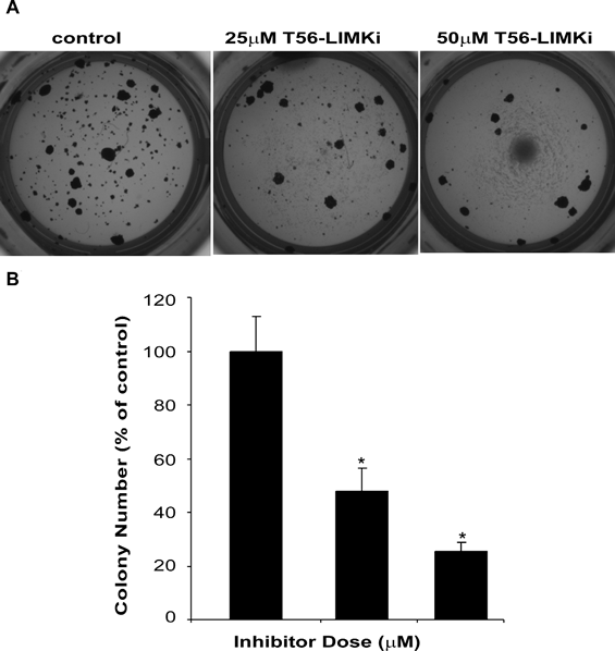 T56-LIMKi inhibits anchorage-independent growth of NF1