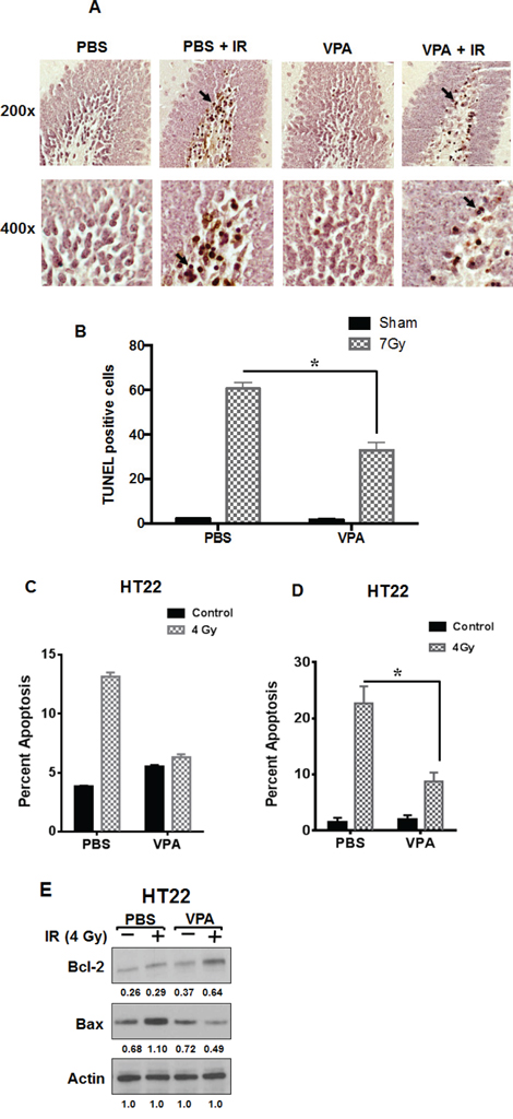 VPA treatment protects hippocampal neurons from radiation-induced apoptosis in vivo and modulates the expression of apoptotic signaling proteins in vitro.