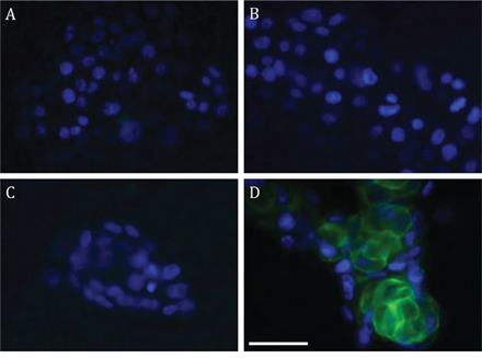 FITC-labeled 8 binds to the surface of CAIX-expressing SK-RC-52 cells.