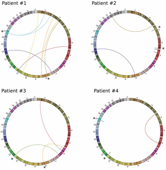 Patient-specific chromosomal rearrangements represented as Circos-plots.