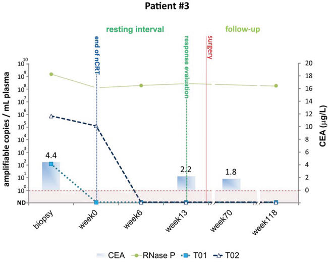 Detection of tumor-specific chromosomal rearrangements in liquid biopsies from Patient #3.