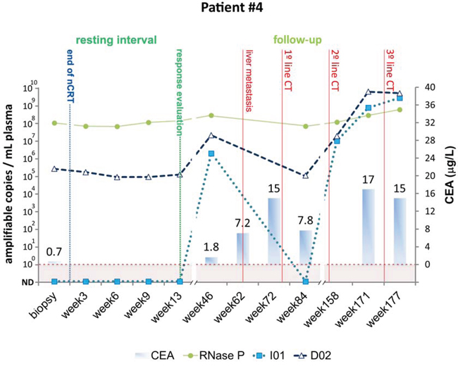 Detection of tumor-specific chromosomal rearrangements in liquid biopsies from Patient #4.