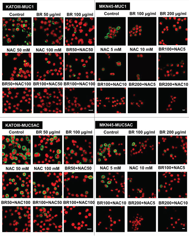 Immunofluorescence staining of gastric cancer cells.