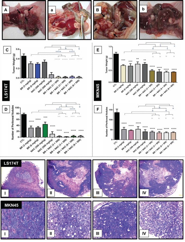 Inhibitory effects of intraperitoneal administration of BR and NAC on tumor burden and mucin products of the in vivo models of gastrointestinal cancer.