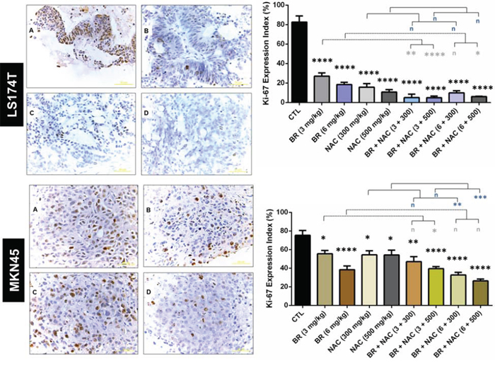 Immunohistochemical analysis of the expression of Ki-67 in the studied gastrointestinal cancer xenografts.
