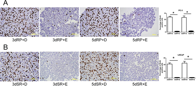 Blockade of the cell cycle re-entry of quiescent prostate cancer cells by cPLA2&#x03B1; inhibition as measured for BrdU incorporation.