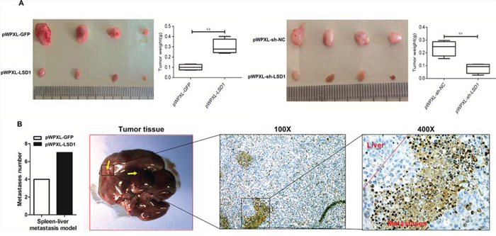 LSD1 regulates tumors proliferation and invasion in GBC xenografts.