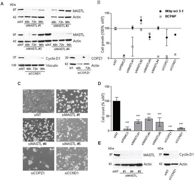 Effect of MASTL, CCND1 and COPZ1 silencing on BCPAP cells.