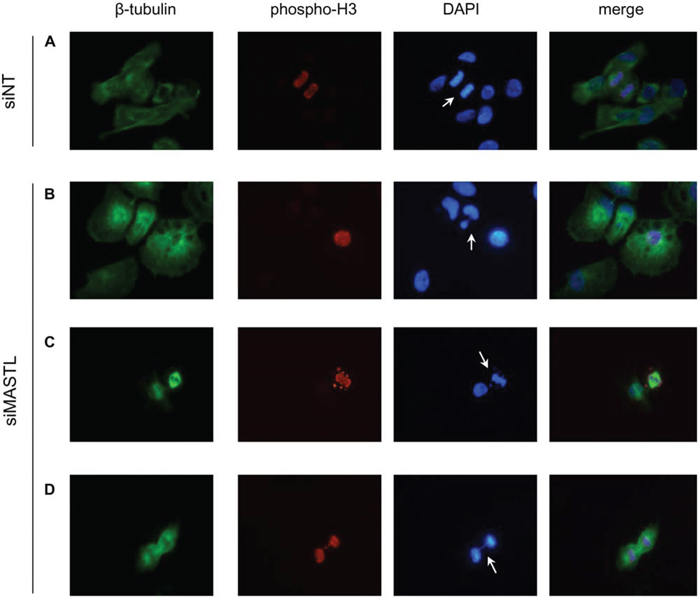 MASTL silencing causes abnormal mitotic figures.