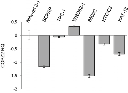 Expression of COPZ2 in thyroid tumor cell lines.