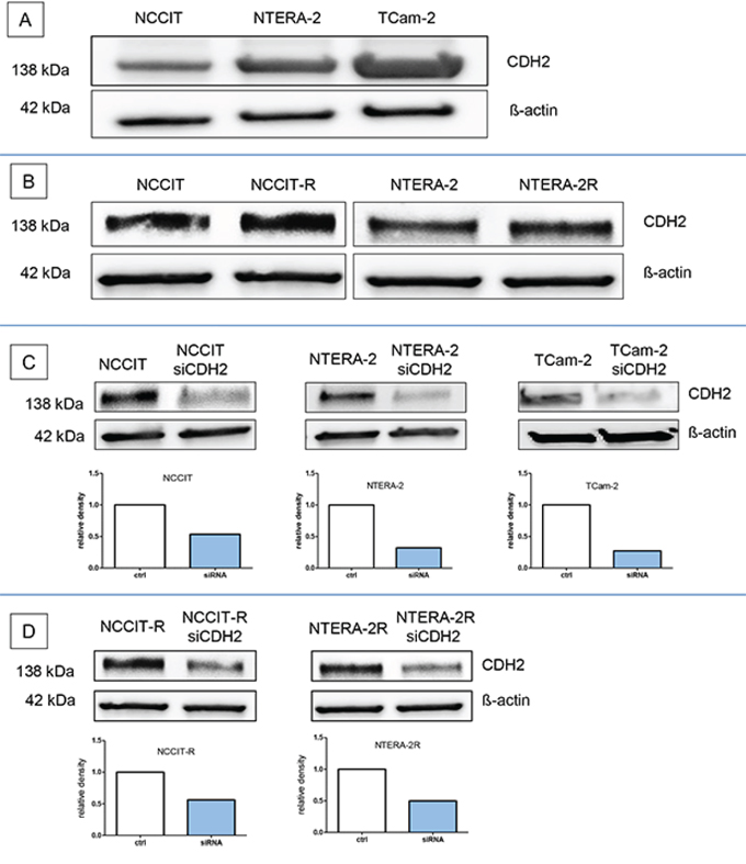 N-cadherin protein is expressed in cisplatin-sensitive and resistant GCT-cell lines.