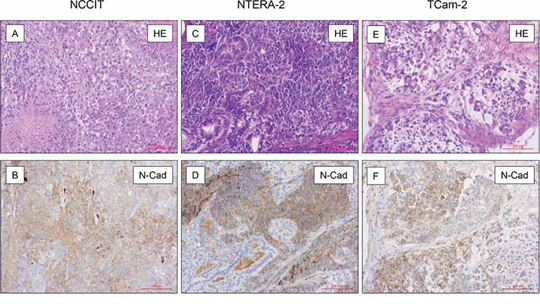 N-cadherin expression in mouse xenografts.