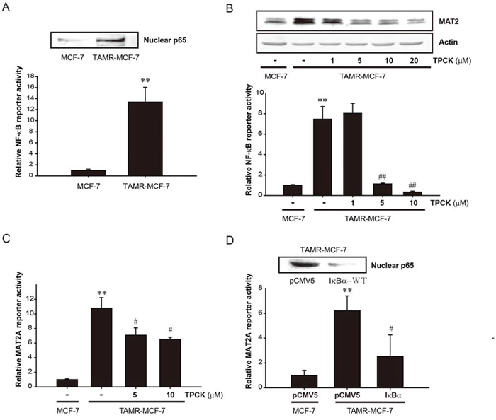 Role of NF-&#x03BA;B in up-regulation of MAT2A gene in TAMR-MCF-7 cells.