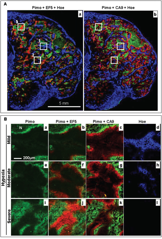 Changes in the hypoxia microenvironment in a representative control HT29&#x2013;9HRE tumor.