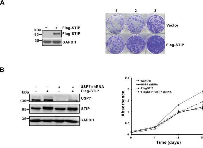 STIP promotes tumor cells growth in a USP7-dependent manner.