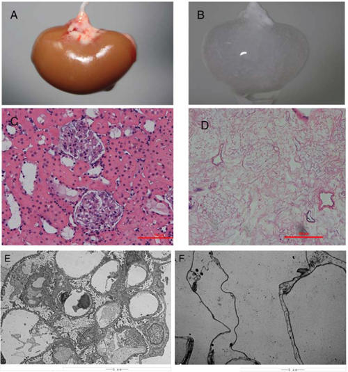 Decellularization of the rat kidney. A&#x0026;B, Gross appearance of a kidney undergoing decellularization at the beginning