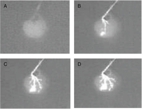 Fluoroangiography of a rat renal scaffold.