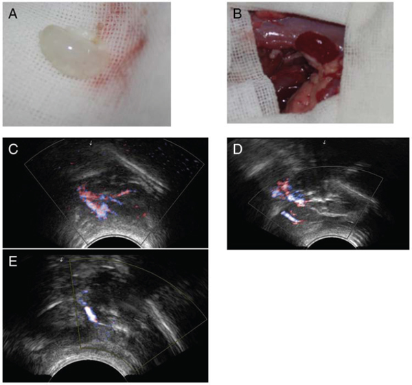 Implantation and explantation of the renal ECM scaffolds.