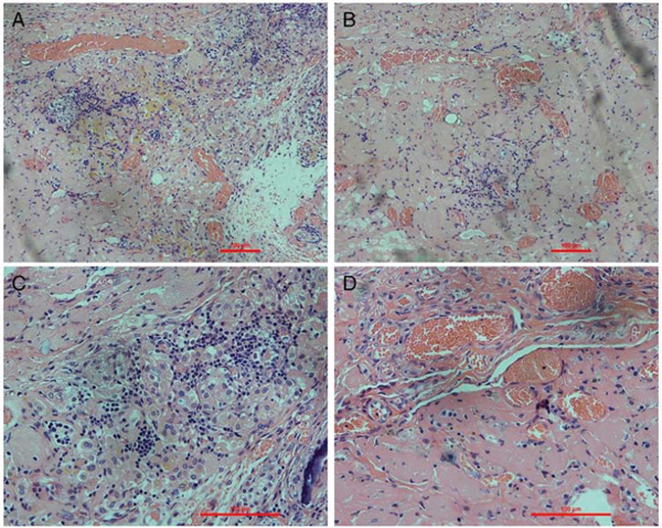 Histological examination of explanted renal ECM scaffolds.