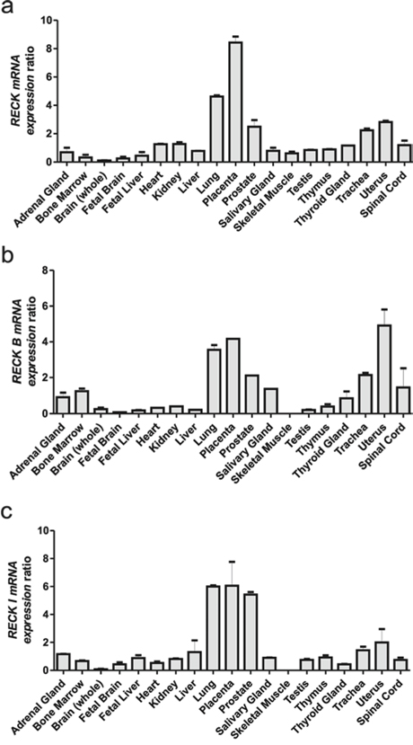 qRT-PCR analysis of the RECK gene mRNA isoforms across a Human Total RNA Master Panel II (Clontech).