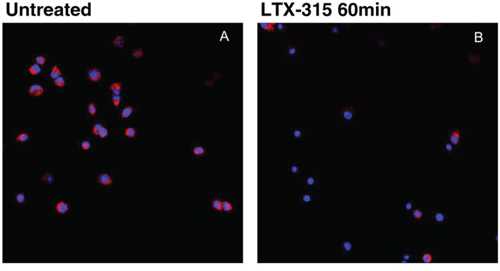 LTX-315 causes decreased mitochondrial membrane potential.