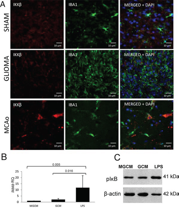 IKK&#x03B2; is upregulated in inflammatory microglia/macrophages accumulating in the ischemic hemisphere but not in glioma-infiltrating microglia/macrophages.