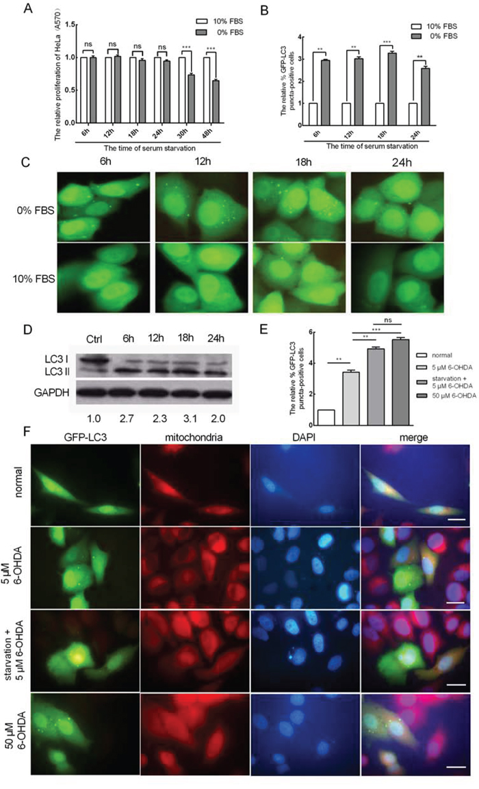 Serum starvation promotes mitophagy in HeLa cells.