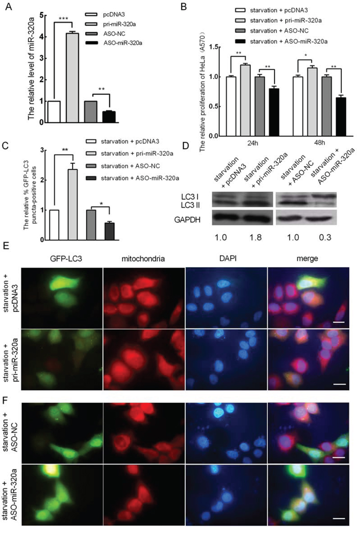 miR-320a induces mitophagy in HeLa cells.