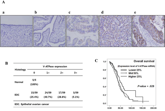 V-ATPase immunoreactivity in human ovarian epithelium and survival analysis based on mRNA expression of V-ATPase in patients with epithelial ovarian cancer (TCGA data).