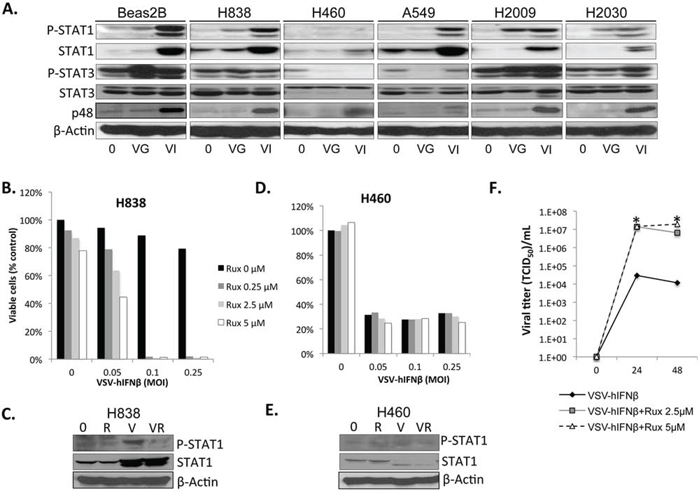 NSCLC cells are defective in IFN response to viral infection.