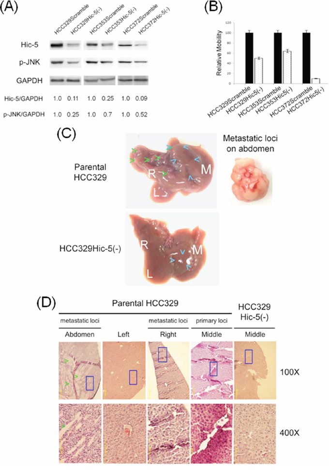 Depletion of Hic-5 suppressed JNK phosphorylation and progression of HCC329.