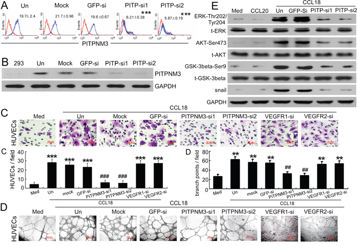 CCL18 enhanced HUVEC migration and tube formation via PITPNM3.