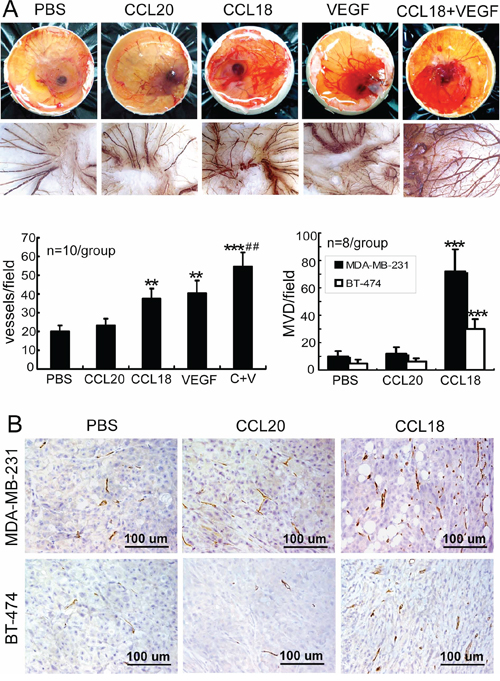 CCL18 promoted angiogenesis in vivo.