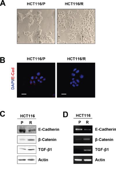 Acquisition of EMT phenotype in 5-FU resistant cells.